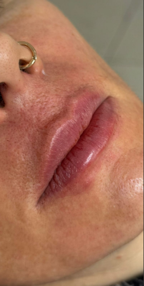 Depois da harmonização