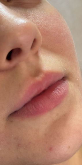 Antes da harmonização